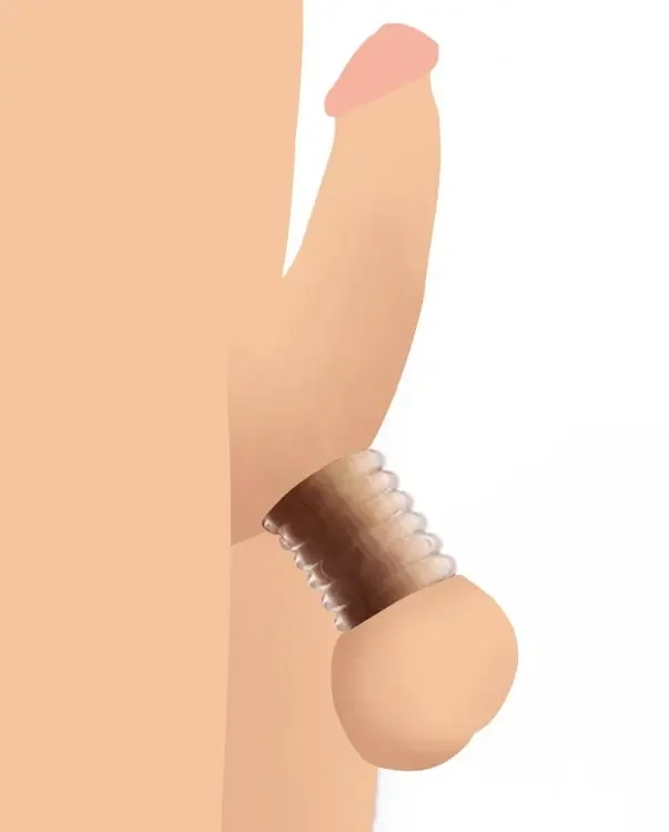 Ballstretcher Ring-Set